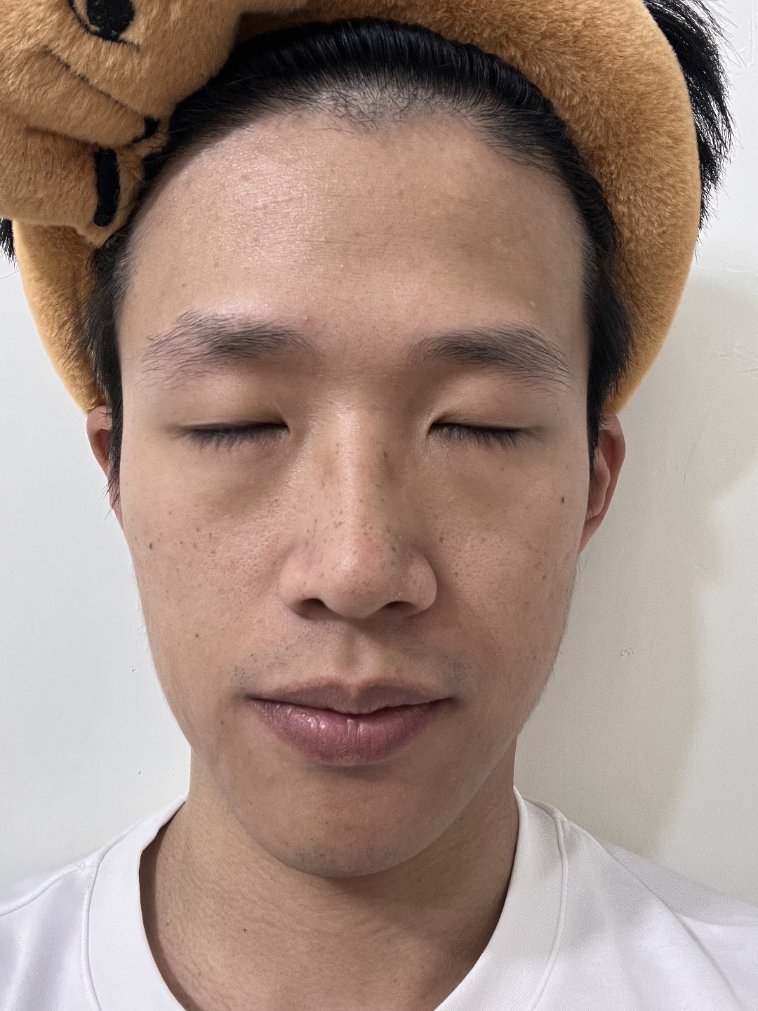 Face