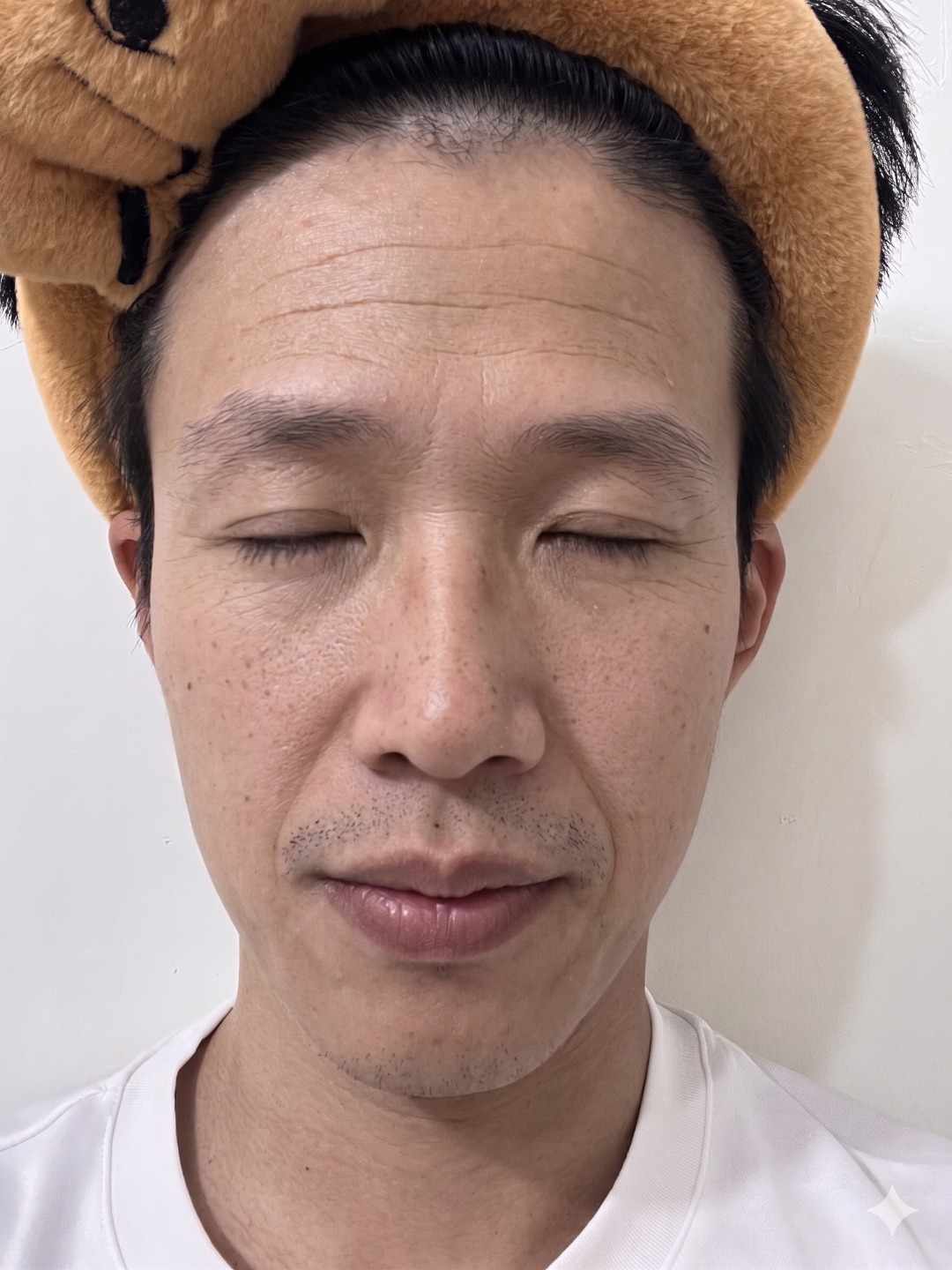 Face